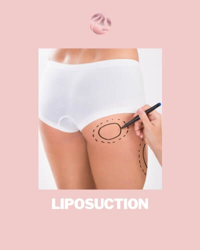 Liposuction BAC